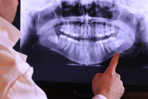 Best Emergency Broken Tooth Repair in Waynesburg, PA